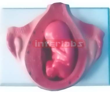 UTERUS WITH EMBRYO (4-5 MONTH)